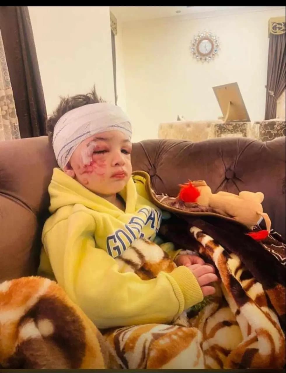 مراسل الأفضل نيوز في الجنوب: الطفل "الشهيد الحي" حسين عامر عاد الى منزله