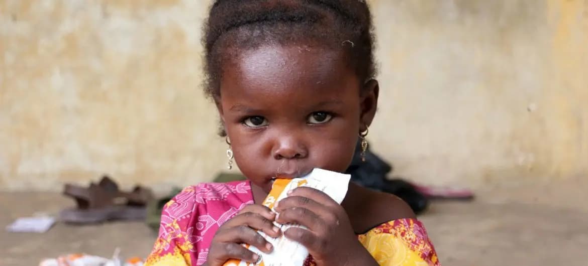 سوء تغذية يقتل 652 طفلاً