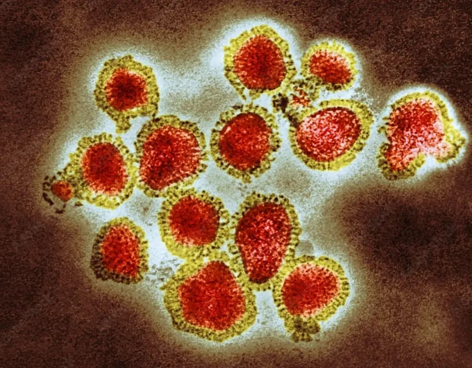 فايروس سريع الانتشار يضرب لبنان.. و"الصحة" تحذر!