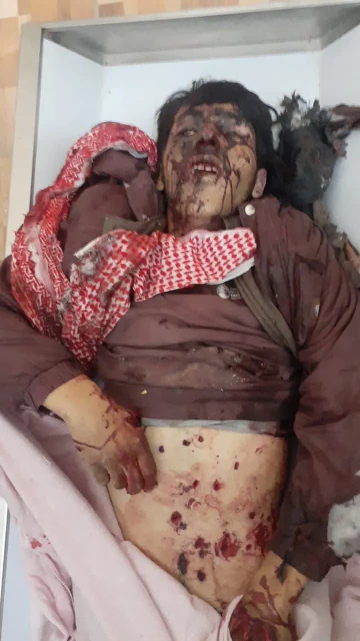 قتيل وجريح في رأس بعلبك بانفجار لغم