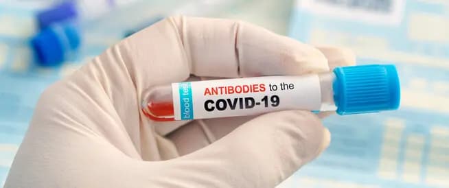 انخفاض بعداد كورونا..