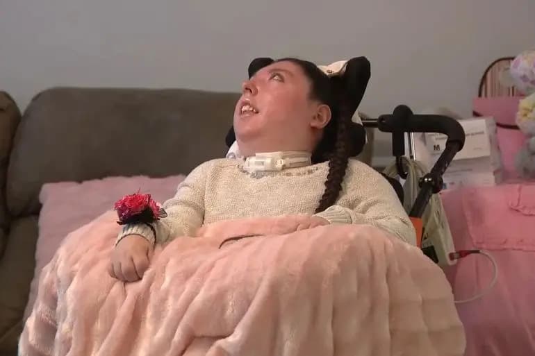 لو باريزيان: "معجزة طبية".. أميركية وُلدت بلا دماغ تحتفل اليوم بعيدها الـ20